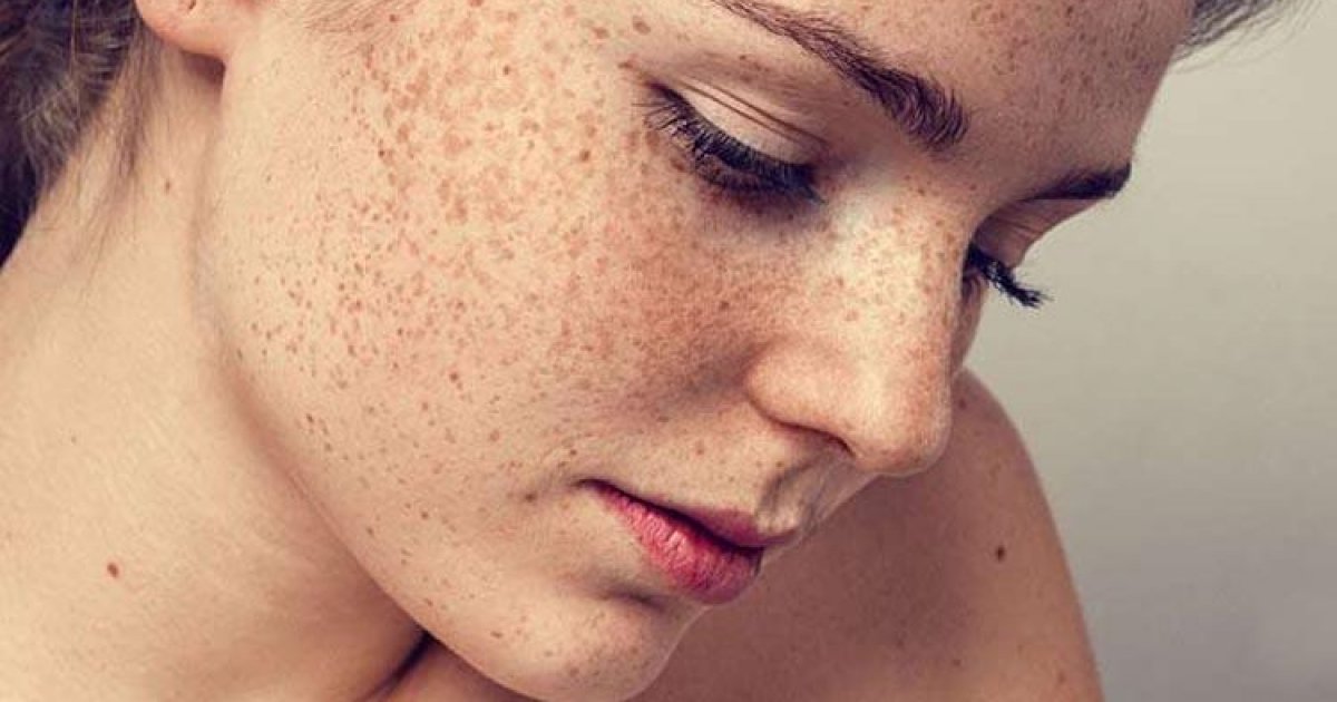 মুখের “মেস্তা” কেন হয় ?