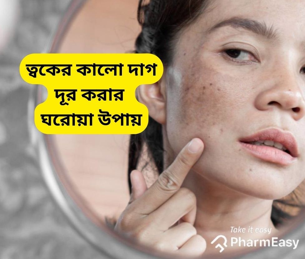 মুখের দাগ দূর করার উপায়